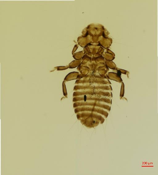 Myrsidea dukhunensis Ansari, 1951 - 010661839__2017_07_24-Scene-1-ScanRegion0