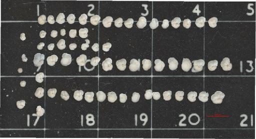 Globorotalia menardii (d'Orbigny) - ZF5771