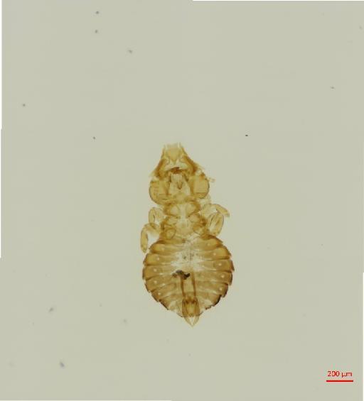 Saemundssonia stammeri Timmermann, 1959 - 010692174__2017_08_11-Scene-1-ScanRegion0