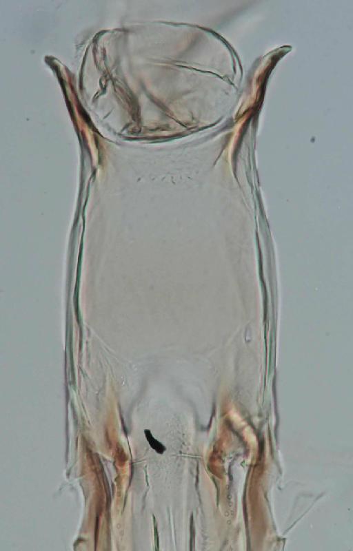 Simulium (Xenosimulium) neireti Roubaud, 1905 - 010194558_S_X_neireti_Larva_Cibarium