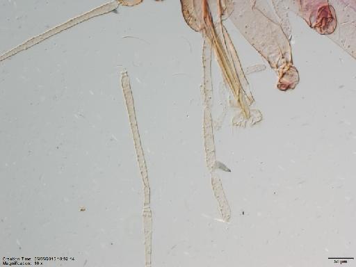 Lutzomyia aulari species group Verrucarum Feliciangeli et al., 1984 - Lutzomyia_aulari-BMNH(E)1722088_HT-male_mouthparts-10x.tif