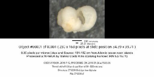 Beella digitata (Brady, 1879) emend. Banner and Blow, 1959 - ZF6208-Globigerina-digitata_obj00001_plane000.jpg