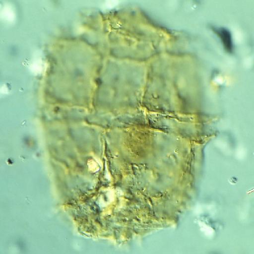 Egmontinium polyplacophorum Gitmez & Sarjeant, 1972 - FD143(1)-1.tif