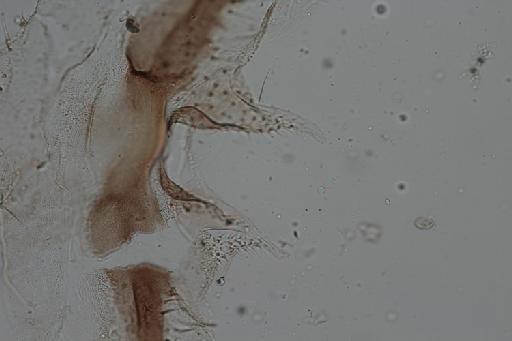 Simulium (Trichodagmia) cristalinum species group Tarsatum Coscarón & Py-Daniel, 1989 - 010195927_Simulium_Trichodagmia_cristalinum_ST8