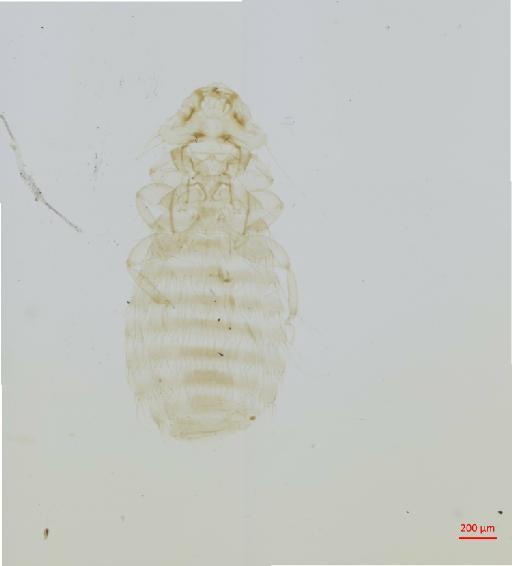 Menacanthus falcatus colinus Carriker, 1946 - 010658079__2017_07_24-Scene-2-ScanRegion1