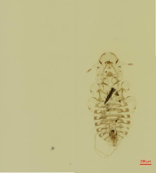 Corvonirmus saliemi Ansari, 1957 - 010670869__2017_07_31-Scene-1-ScanRegion0