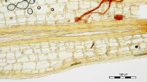 Syrrhopodon ligulatus Mont. - Syrrhopodon ligulatus Mont._BM000663969base.