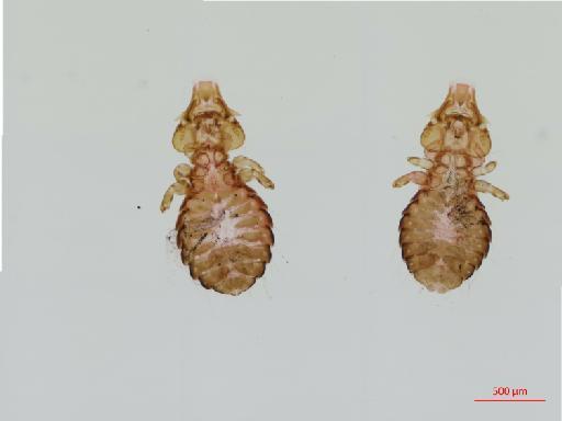 Saemundssonia halobaenus Timmermann, 1965 - 010691244__2017_08_11-Scene-1-ScanRegion0