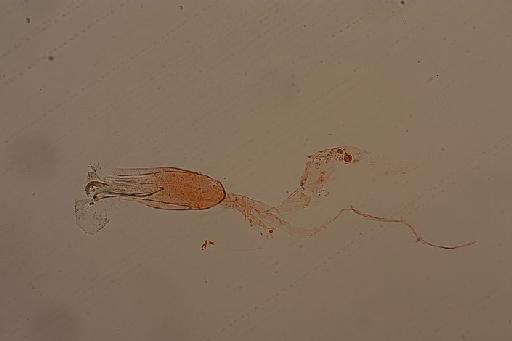 Endotricha primulina Hampson - Endotricha_primulina_Hampson_1916_Type_BMNH(E)#986602_Slide4485_male_Genitalia04