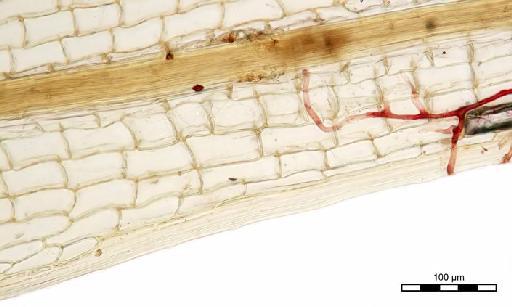 Syrrhopodon gaudichaudii Mont. - Syrrhopodon erectifolius_BM000677469basemargin.