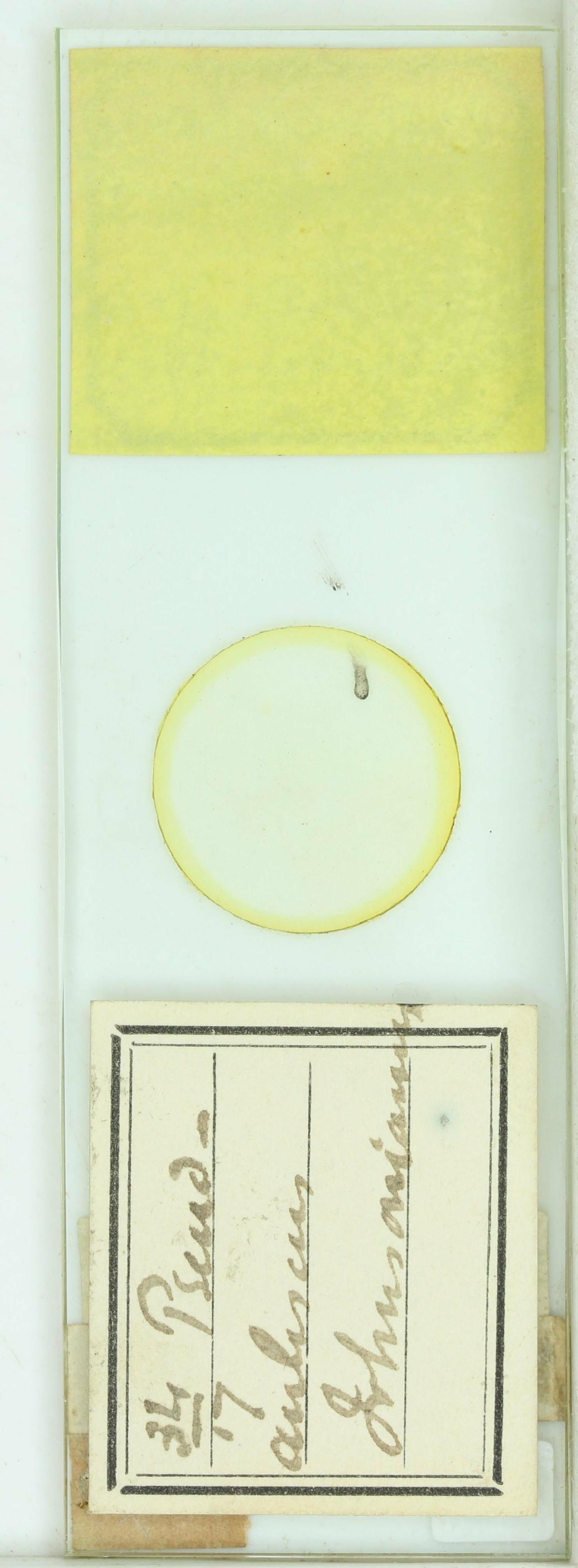 To NHMUK collection (Auliscus johnsonianus Grev.; Holotype; NHMUK:ecatalogue:4739410)