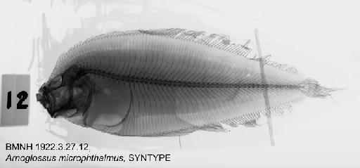 Arnoglossus microphthalmus (von Bonde, 1922) - BMNH 1922.3.27.12, SYNTYPE, Arnoglossus microphthalmus Radiograph