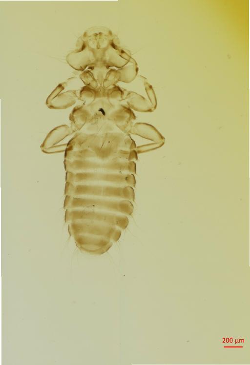 Myrsidea clayae birmensis Klockenhoff, 1969 - 010661465__2017_07_24-Scene-1-ScanRegion0