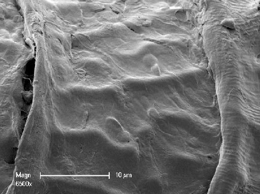 Nitella gelatinifera (R.D.Wood) R.D.Wood - OosporeDetail