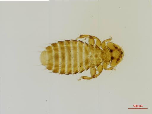 Holomenopon africanum (Kellogg & Paine, 1911) - 010657477__2017_07_21-Scene-1-ScanRegion0