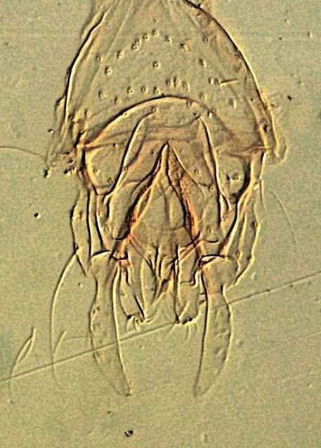 Tanytarsus bifurcus Freeman, 1958 - 010210370-Tanytarsus_bifurcus-DIC-100x