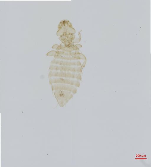 Amyrsidea oculeae Price & Elbel, 1969 - 010651008__2017_07_18-Scene-1-ScanRegion0