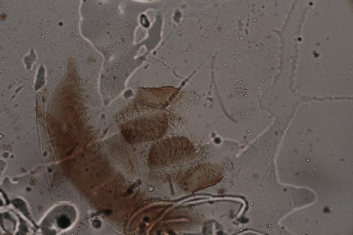 Simulium (Trichodagmia) claricentrum species group Pictipes Adler, 1990 - 010195886_Simulium_Shewellomyia_claricentrum_cercus paraproct