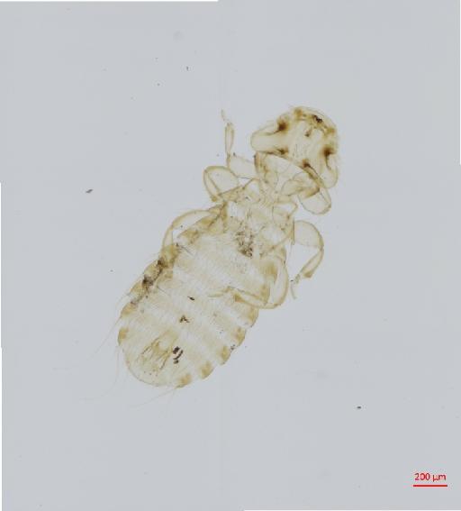 Amyrsidea (Cracimenopon) chamaepeta Carriker, 1950 - 010651171__2017_07_18-Scene-1-ScanRegion0