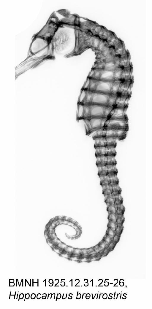 Hippocampus brevirostris Schinz & Cuvier, 1822 - BMNH 1925.12.31.25-26, Hippocampus brevirostris, Radiograph