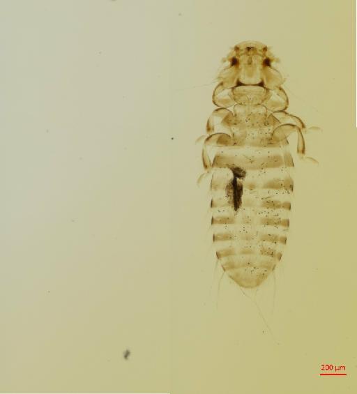 Colpocephalum tirkhan Ansari, 1951 - 010655710__2017_07_20-Scene-1-ScanRegion0