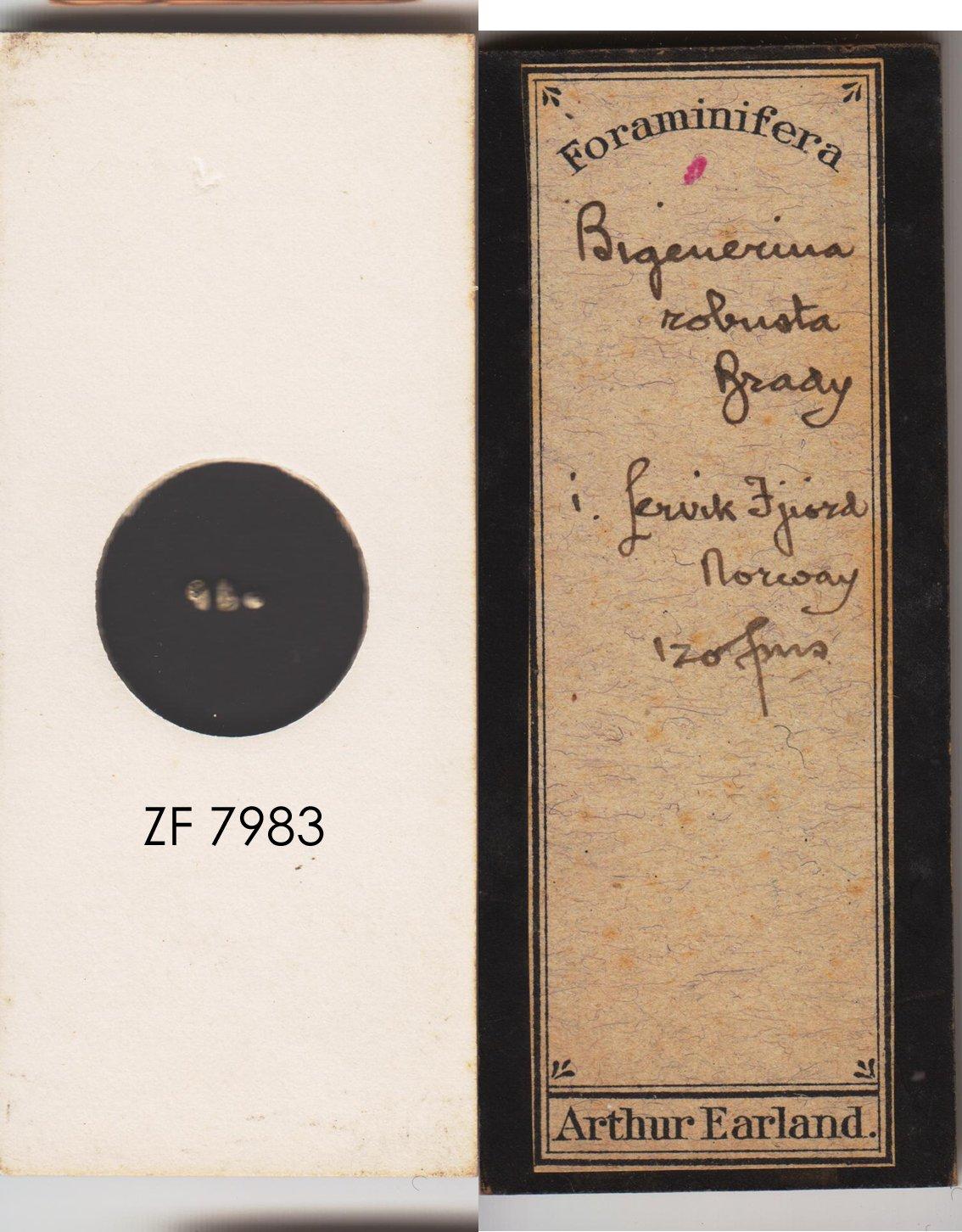 To NHMUK collection (Bigenerina robusta Brady, 1881; NHMUK:ecatalogue:9055505)