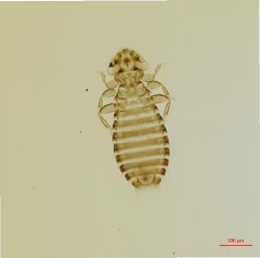 Pseudomenopon mendesi Tendeiro, 1965 - 010663474__2017_07_26-Scene-1-ScanRegion0