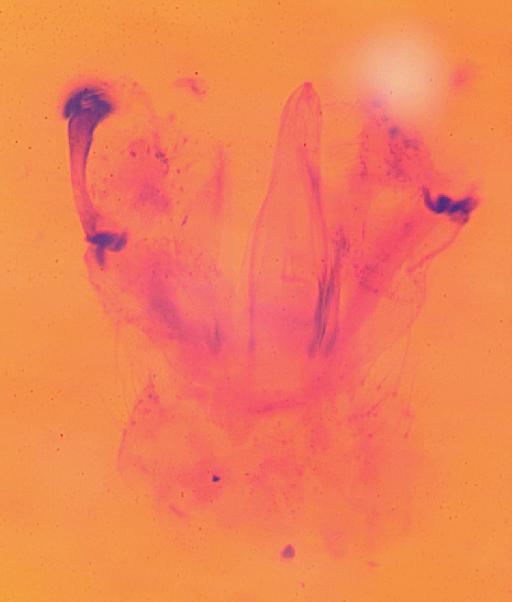 Geranomyia bancrofti Alexander - 012810480-Geranomyia_bancrofit-HOLOTYPE-genitalia3-B-100_0x