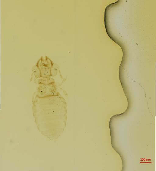 Procavicola (Condylocephalus) dissimilis Werneck, 1941 - 010697470__2017_08_16-Scene-5-ScanRegion4