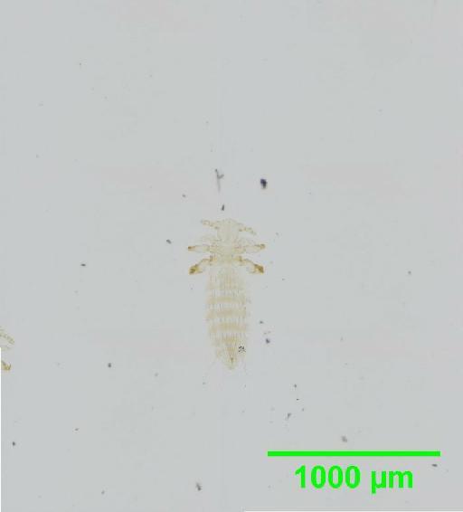 Polyplax serrata Burmeister, 1839 - 010155700__2015_12_24_s2