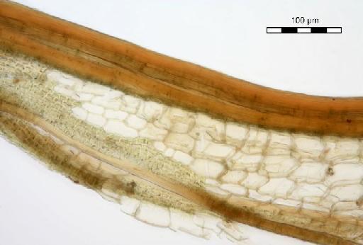 Syrrhopodon prolifer var. acanthoneuros (Müll.Hal.) Müll.Hal. - Syrrhopodon epapillousus_BM000663616hyalineshoulder.