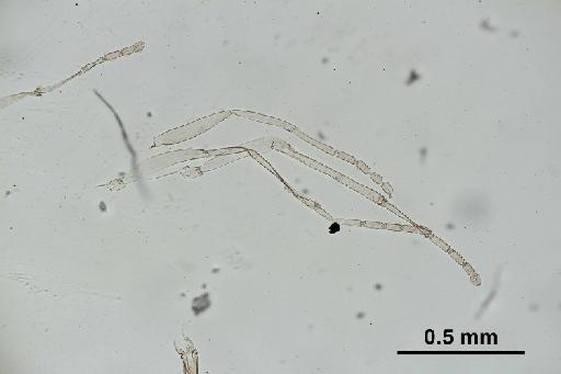 Trichomyia cirrata Coquillett, 1902 - Trichomyia_cirrata-010210264-legs_2-100_0x-scale