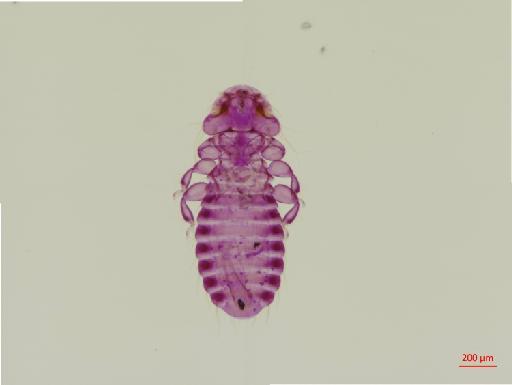 Austromenopon paululum Kellogg & Chapman, 1899 - 010652041__2017_07_19-Scene-1-ScanRegion0