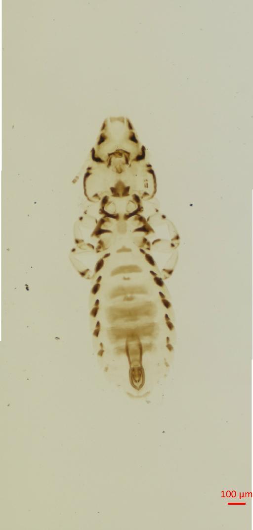 Quadraceps sellatus praestans Kellogg, 1896 - 010688058__2017_08_10-Scene-1-ScanRegion0