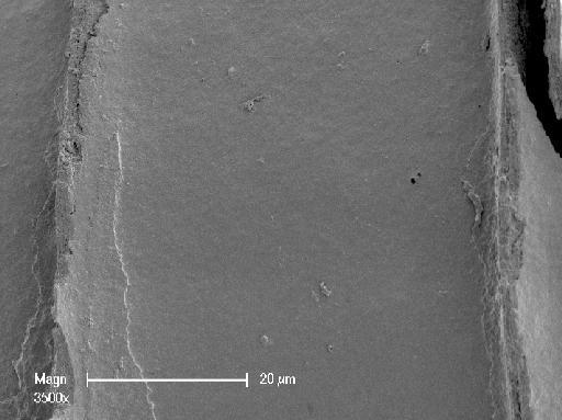 Chara fibrosa var. drummondii (A.Braun) C.Agardh - OosporeDetail