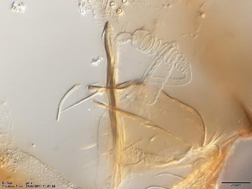 Lutzomyia (Nyssomyia) olmeca olmeca (Vargas & Diaz Najera, 1959) - Lutzomyia_olmeca_nociva-BMNH(E)1722066_PT-female_spermathecae-40x.tif