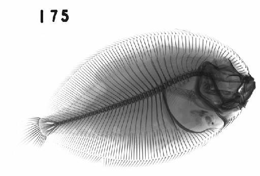 Bothus maculiferus (Poey, 1860) - BMNH 1863.8.7.175 Bothus maculiferus