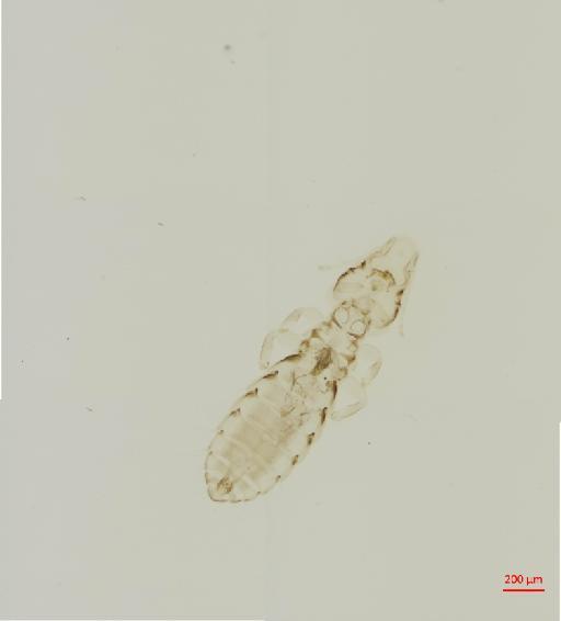 Quadraceps sinensis Timmermann, 1954 - 010688491__2017_08_10-Scene-1-ScanRegion0