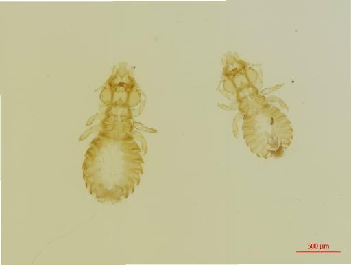 Anatoecus icterodes obtusus Giebel, 1866 - 010666947__2017_07_28-Scene-1-ScanRegion0