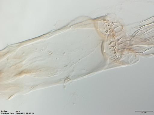 Lutzomyia (Nyssomyia) anduzei Rozeboom, 1942 - Lutzomyia_anduzei-BMNH(E)1722068_ST-female_cibarium-40x.tif