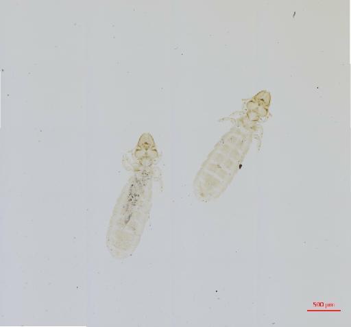 Brueelia straminea Denny, 1842 - 010670898__2017_07_31-Scene-1-ScanRegion0