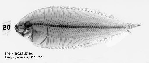 Laeops pectoralis (von Bonde, 1922) - BMNH 1922.3.27.20, SYNTYPE, Laeops pectoralis Radiograph