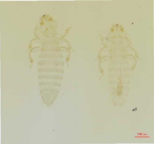 Franciscoloa (Cacamenopon) kimi Price, 1967 - 010656822__2017_07_21-Scene-1-ScanRegion0