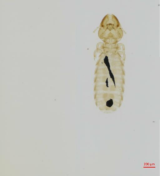 Brueelia eternitatus Ansari, 1956 - 010672828__2017_07_31-Scene-1-ScanRegion0