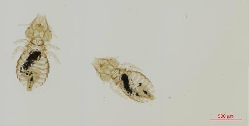 Sturnidoecus galbula Tendeiro, 1963 - 010694499__2017_08_11-Scene-6-ScanRegion5