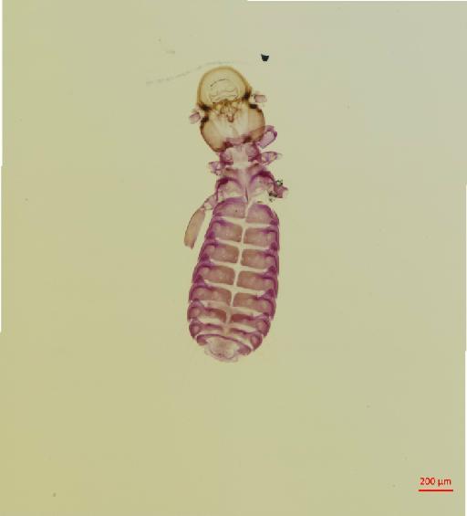 Syrrhaptoecus uncinosus Waterston, 1928 - 010694811__2017_08_15-Scene-1-ScanRegion0