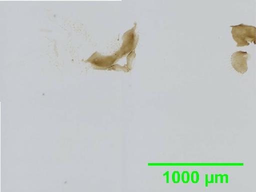 Calopsocus marginatus Thornton, 1984 - 010139001__2016_03_15-4_s3