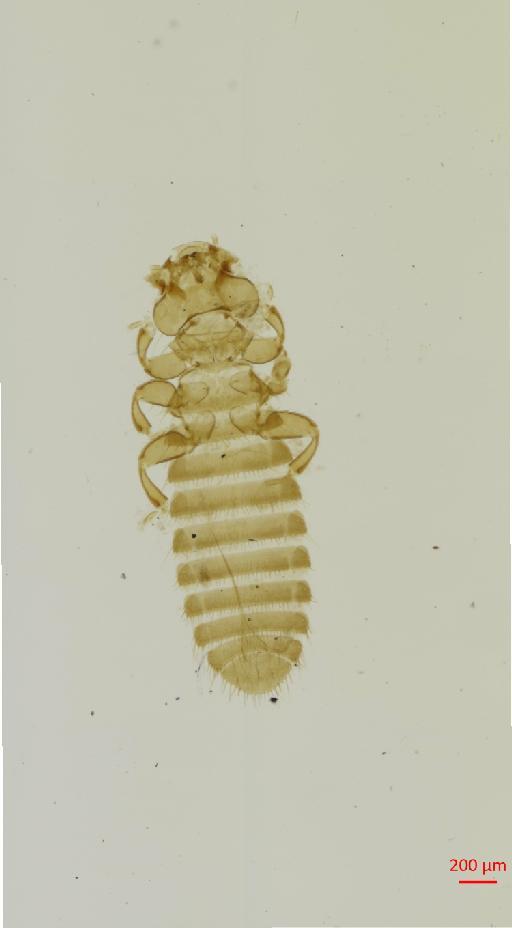 Colpocephalum scopinum Mjoberg, 1910 - 010653989__2017_07_19-Scene-1-ScanRegion0