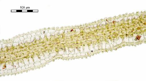 Exostratum asperum (Mitt.) L.T.Ellis - Leucophanes giulianetii_BM000665369margin