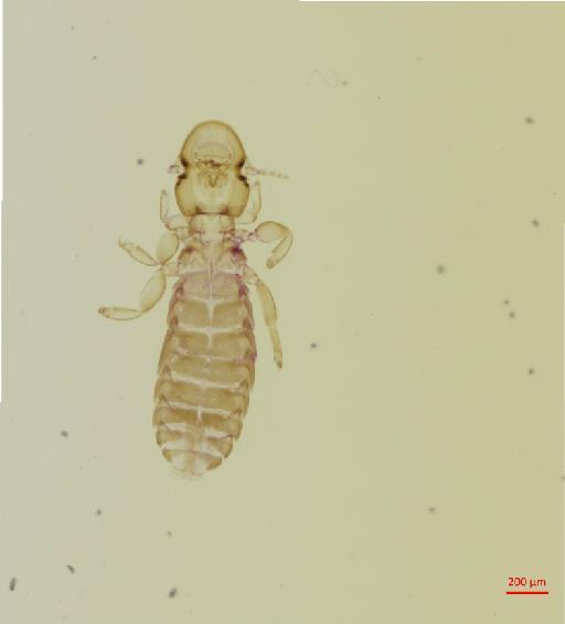 Syrrhaptoecus digonus Waterston, 1928 - 010694718__2017_08_15-Scene-1-ScanRegion0